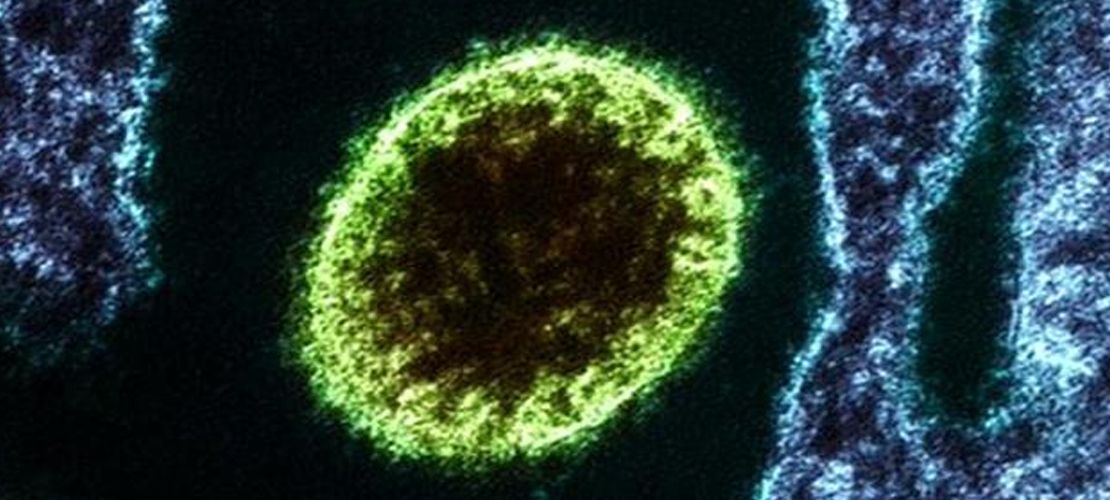 Çin'de ortaya çıkan Langya virüsü nedir, nasıl bulaşır?